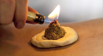 【艾灸知識(shí)】十大常見艾灸不良反應(yīng)，及處理方法！建議收藏！